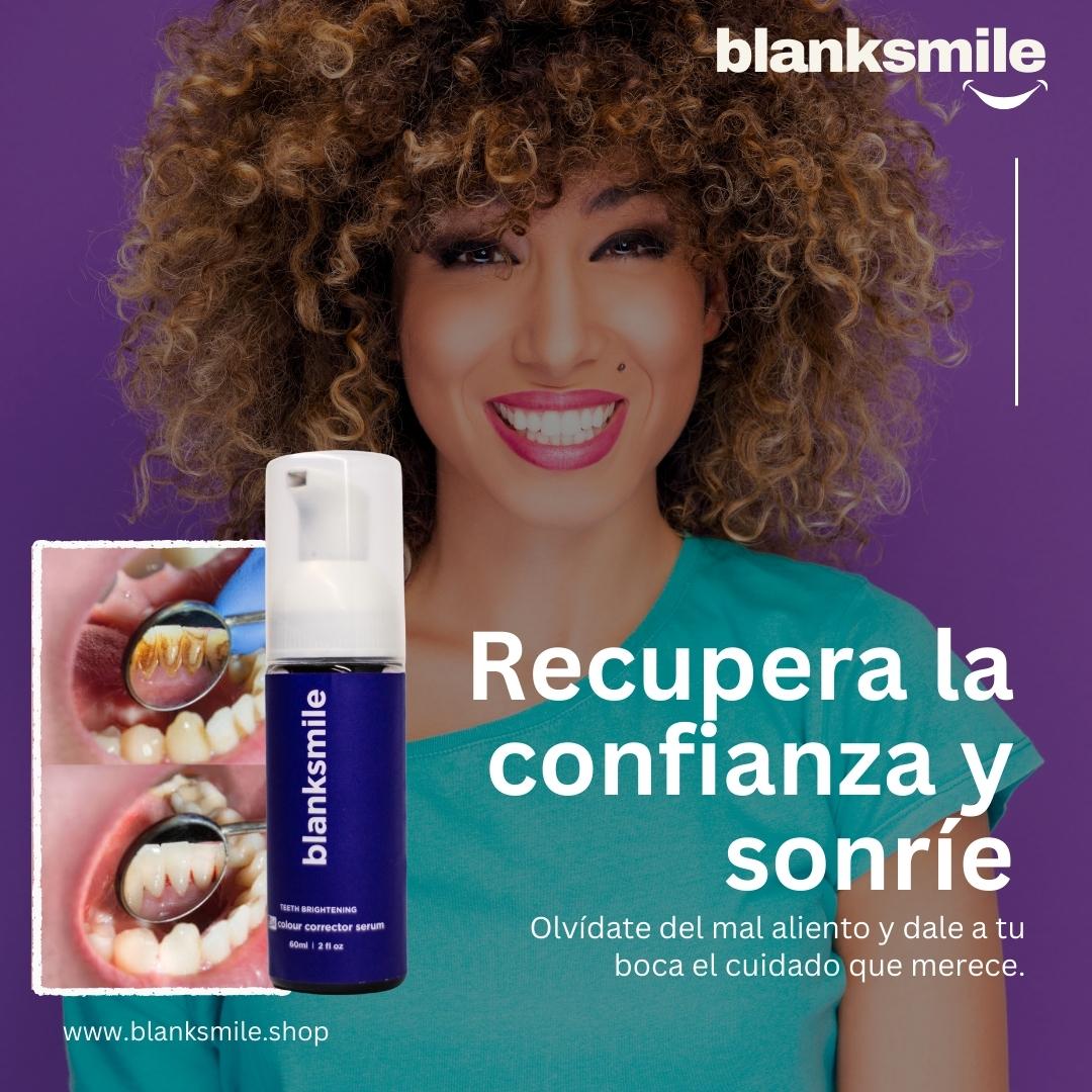 Sonrisa Radiante con el Blanqueador Dental ELHOE V34🦷✨🟣